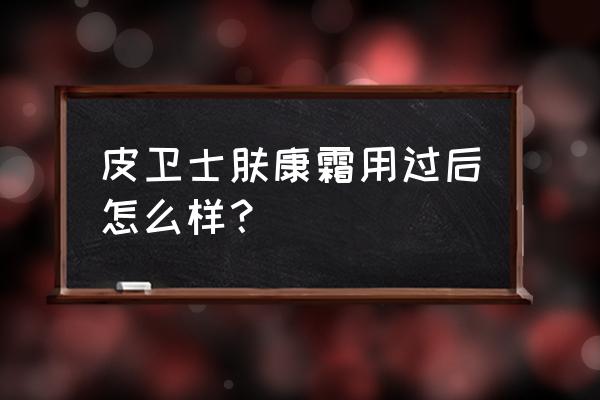 汕头肤康皮肤病好吗 皮卫士肤康霜用过后怎么样？