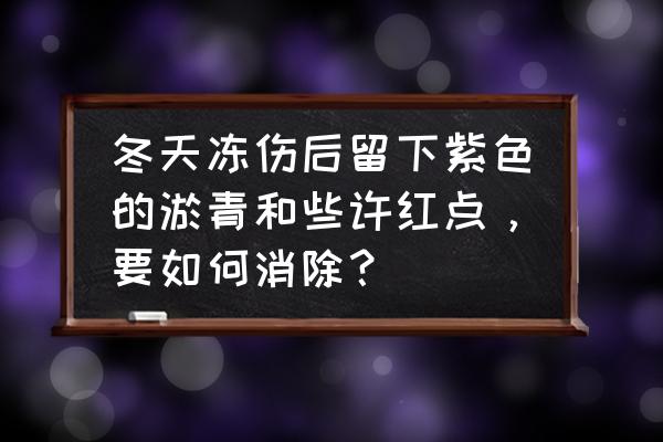 冬天冻脸怎么办小妙招 冬天冻伤后留下紫色的淤青和些许红点，要如何消除？